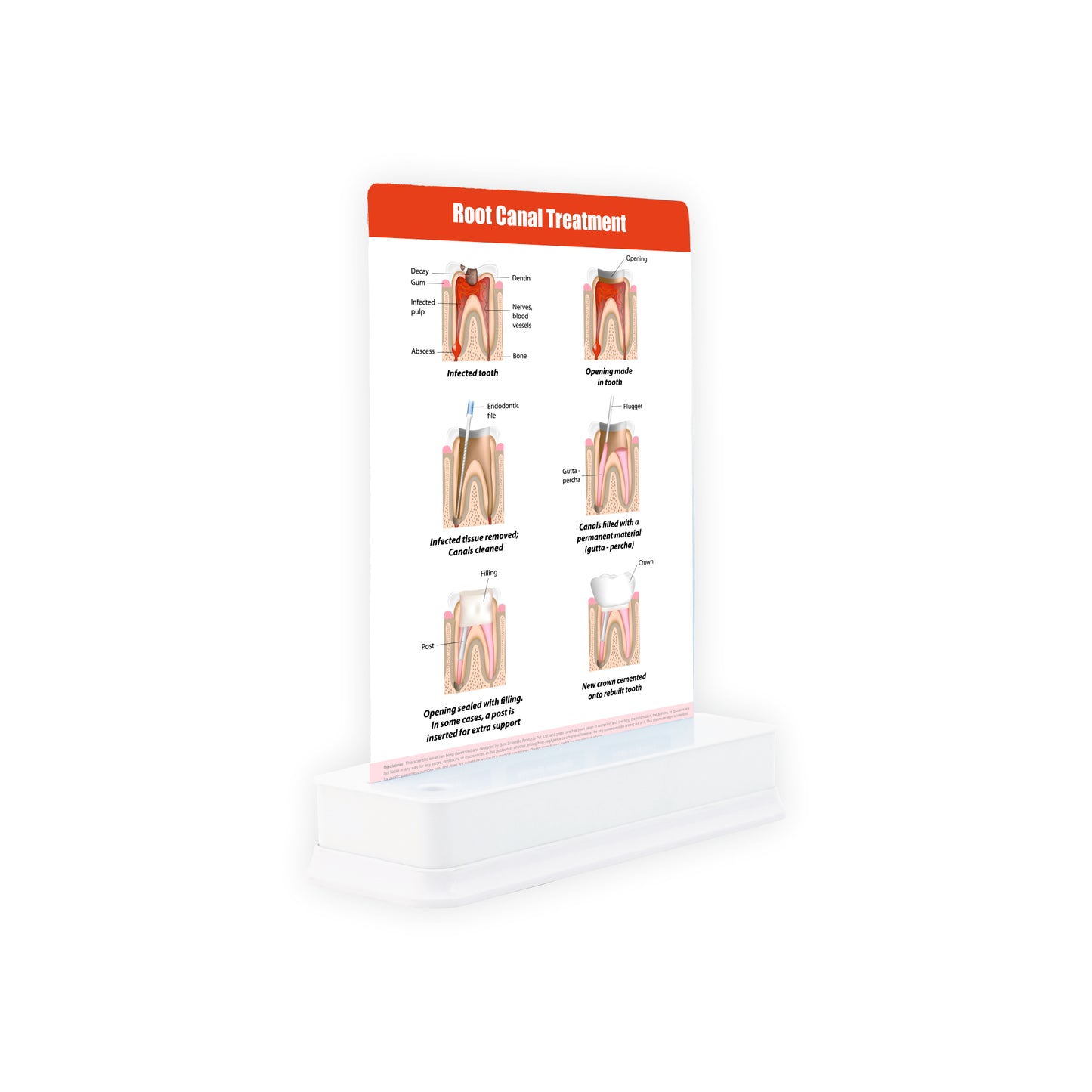 Root Canal Treatment: 1 Slide on stand
