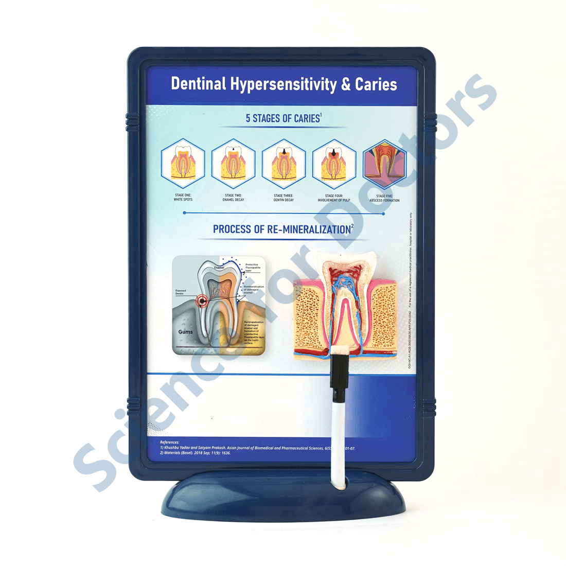 Dental Hypersensitivity and Caries: 3D Therapy Frame