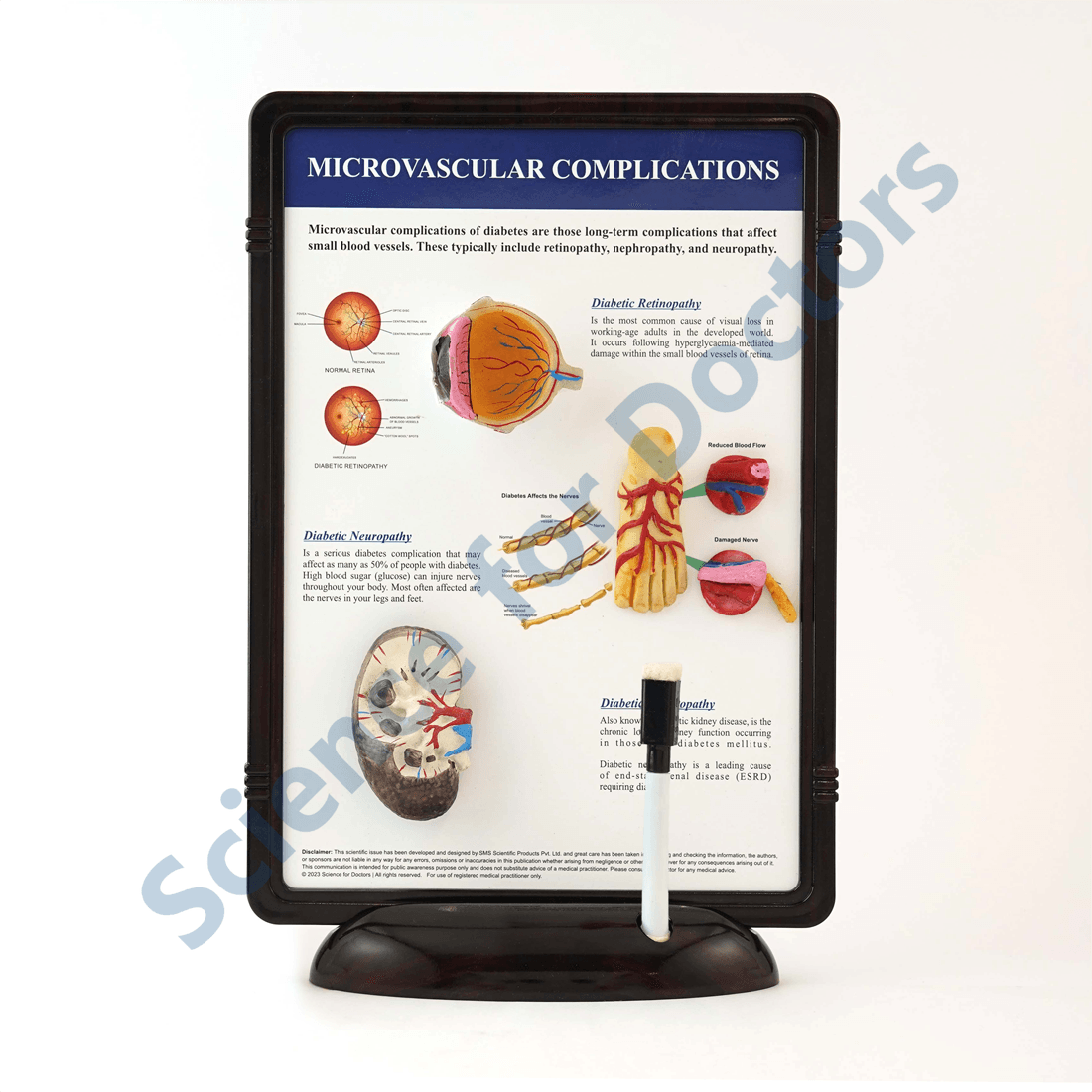 Microvascular Complications: 3D Therapy Frame