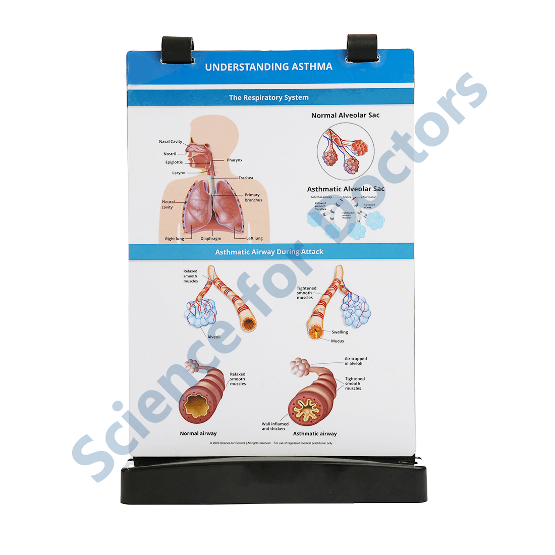 Understanding Asthma: A4 Flip Wipe