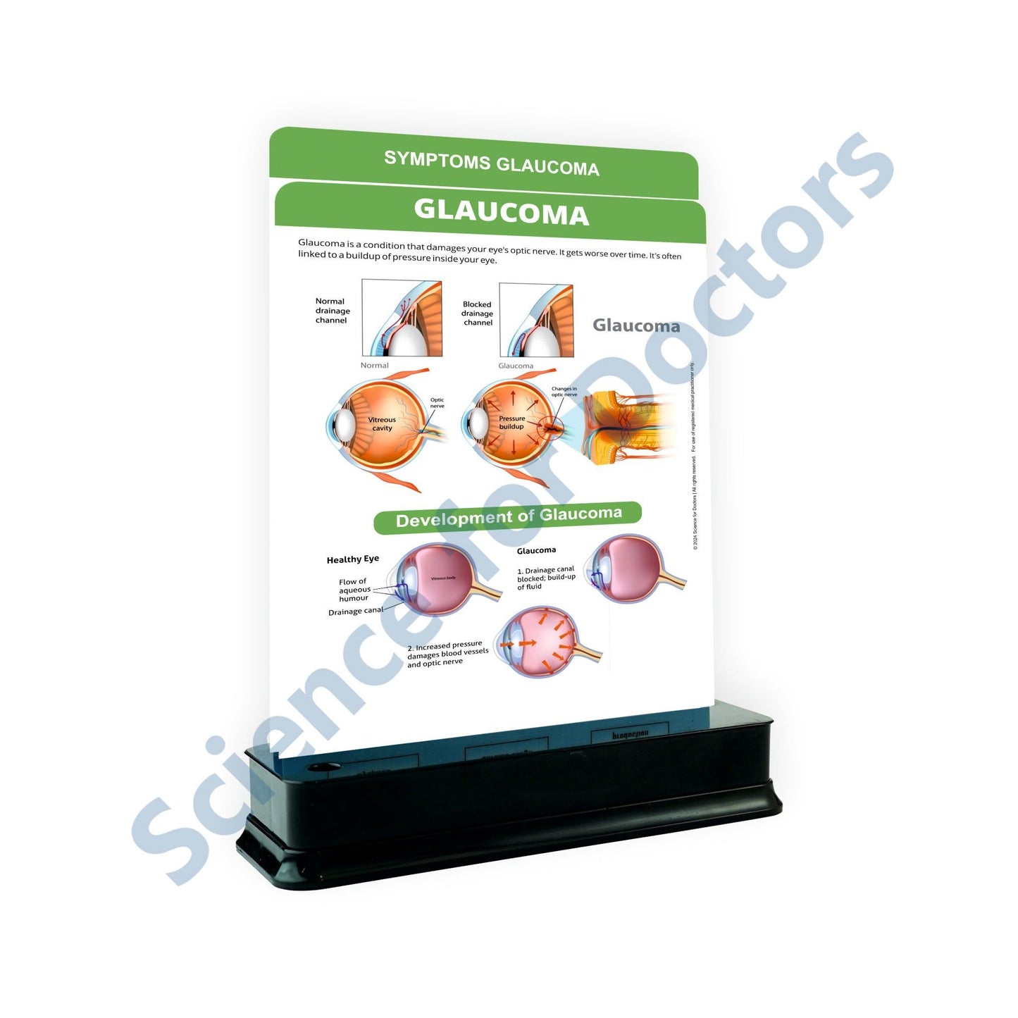 Glaucoma - 2 Slides With Stand