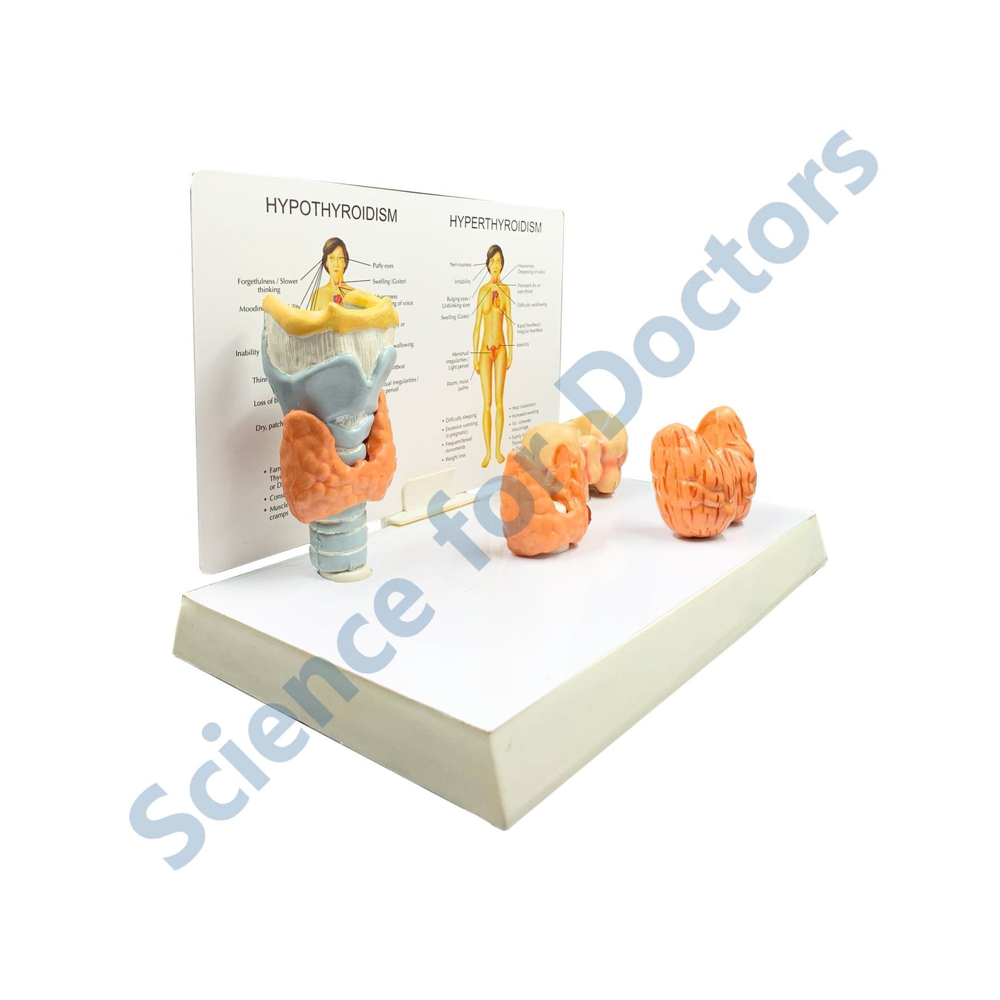 Hypothyroidism: 3D Anatomical Models