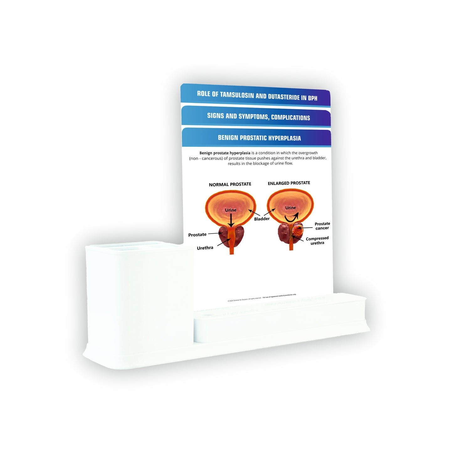 Benign Prostatic Hyperplasia_1: 3 Slides Write & Wipe with Stationary Stand