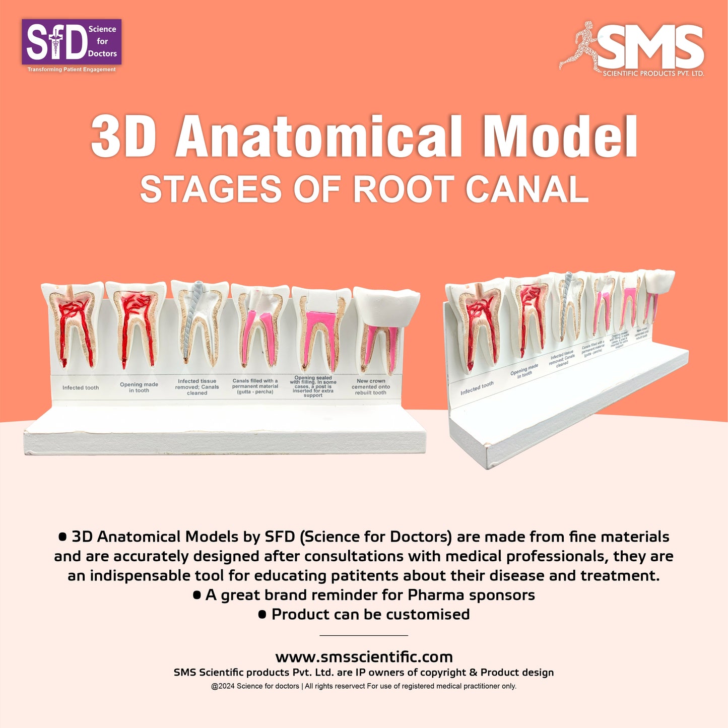 Stages of Root Canal: 3D Anatomical Models