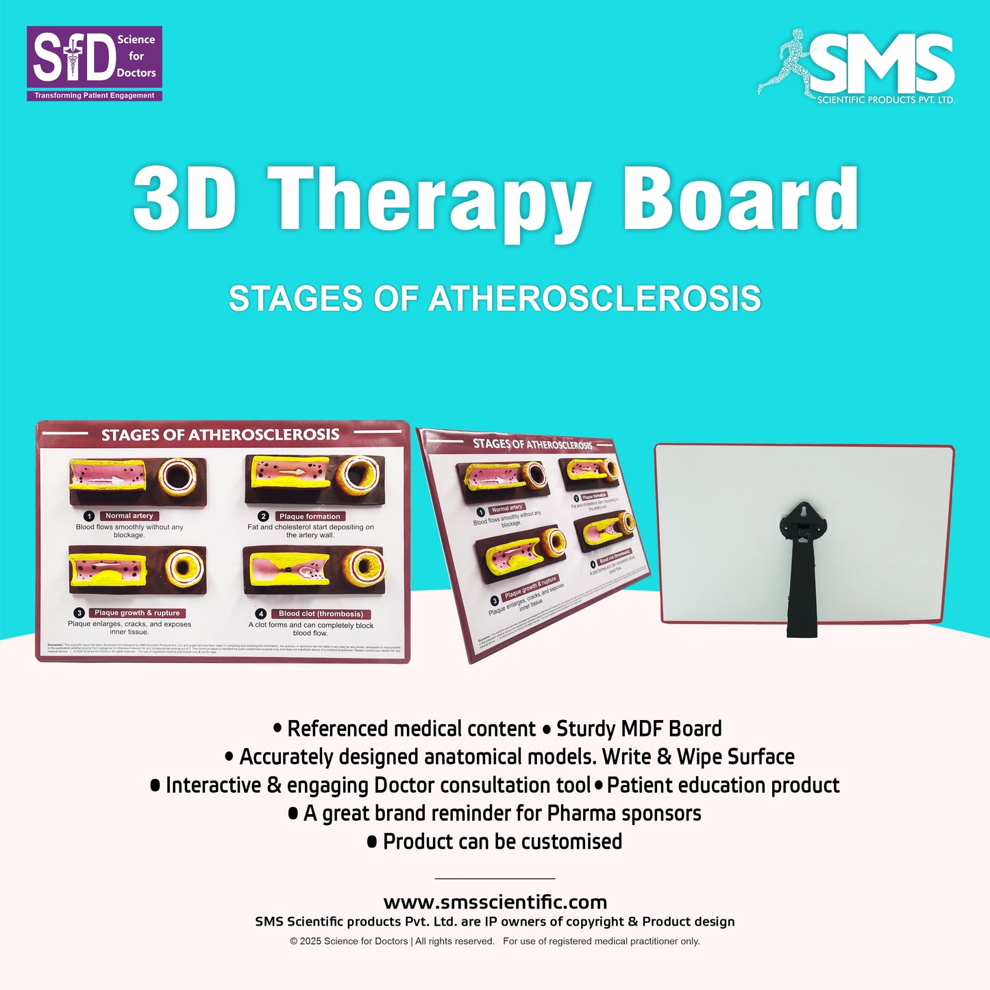 3D Therapy Board - Stages of Atherosclerosis