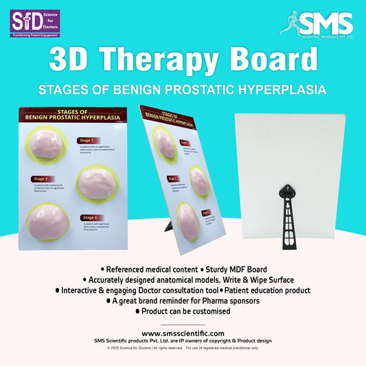 Stages of Benign Prostatic Hyperplasia: 3D Therapy Board