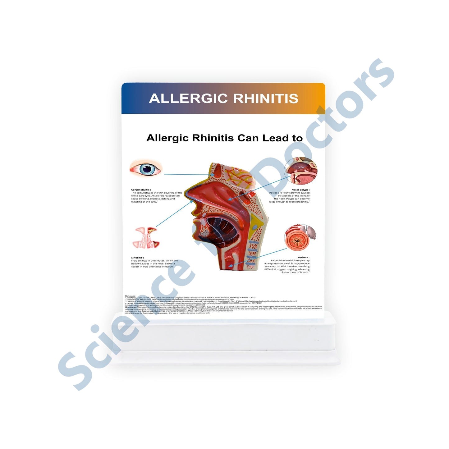 Allergic Rhinitis: 1 Slide on stand