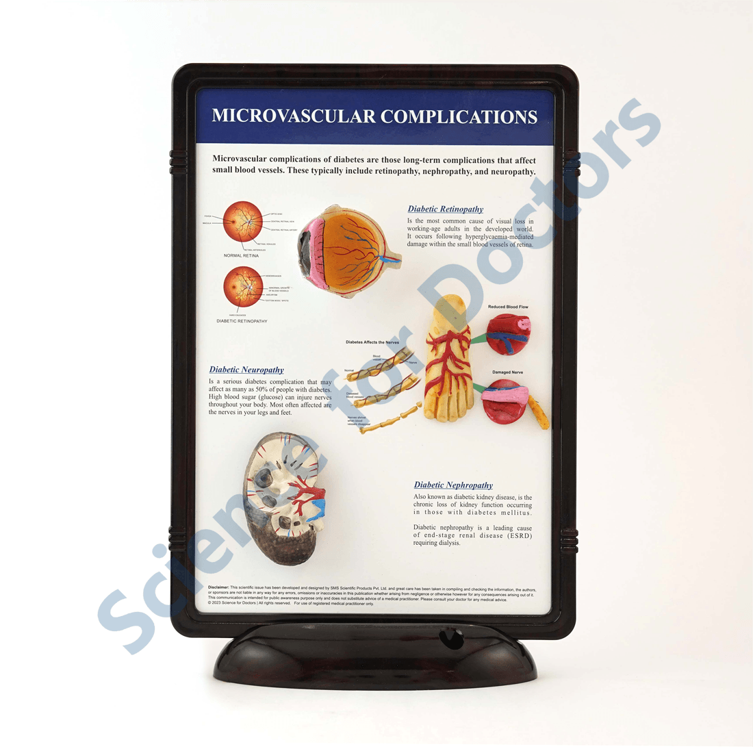 Microvascular Complications: 3D Therapy Frame