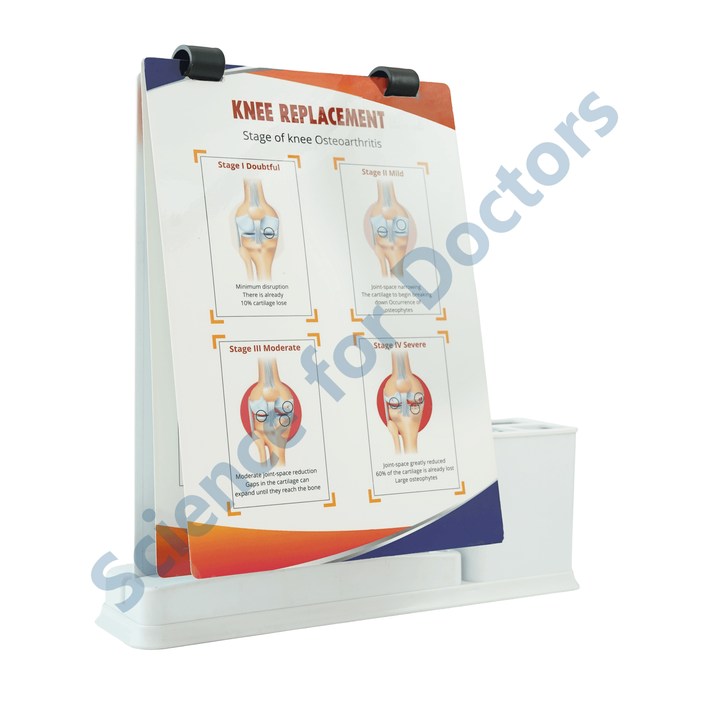 Knee Replacement: A4 Flip Wipe With Stationary Stand