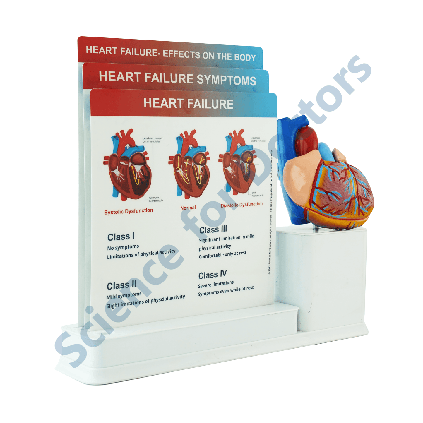 Heart Failure: 3 Slide Write and Wipe with Anatomical Model on Stand