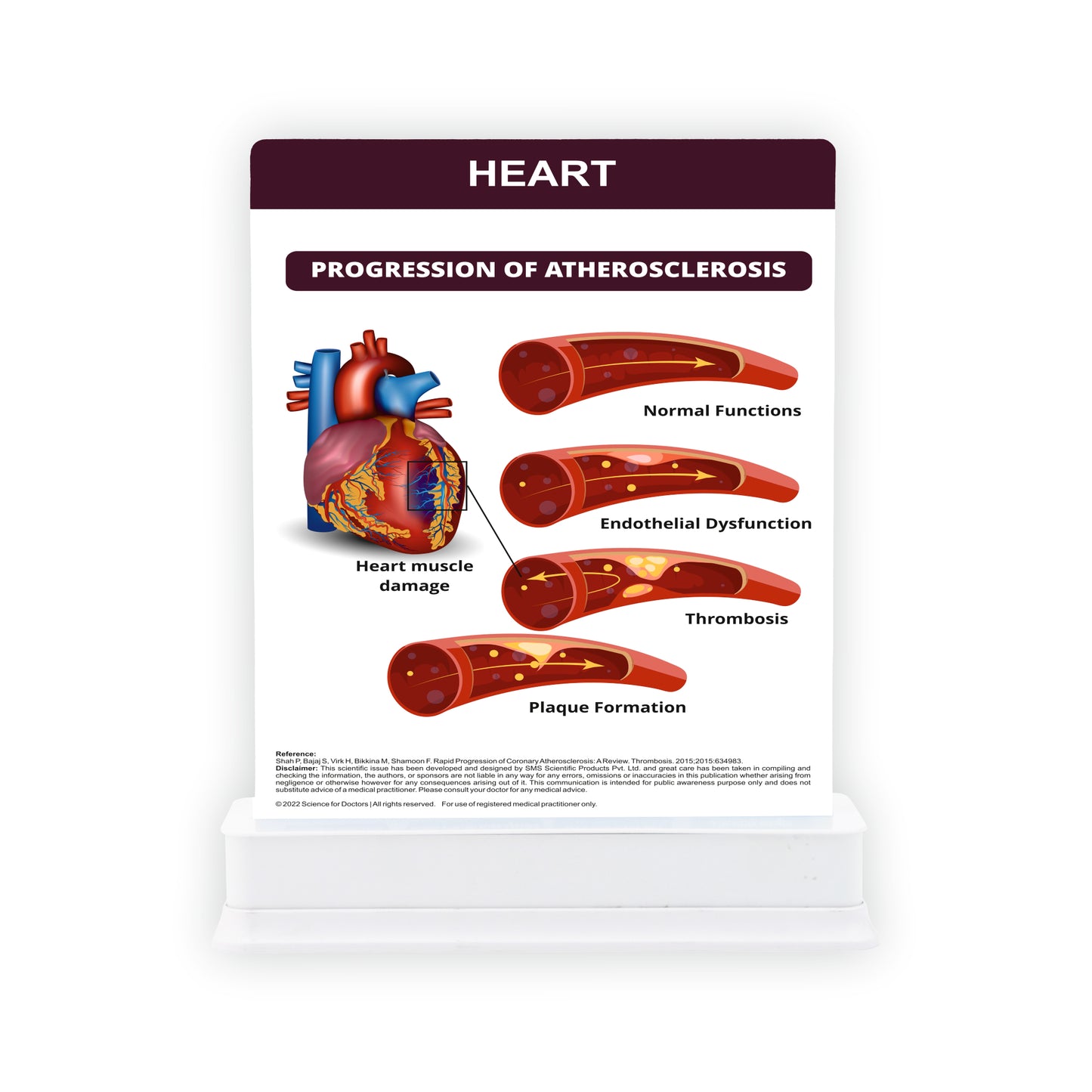 Heart: 1 Slide With Stand