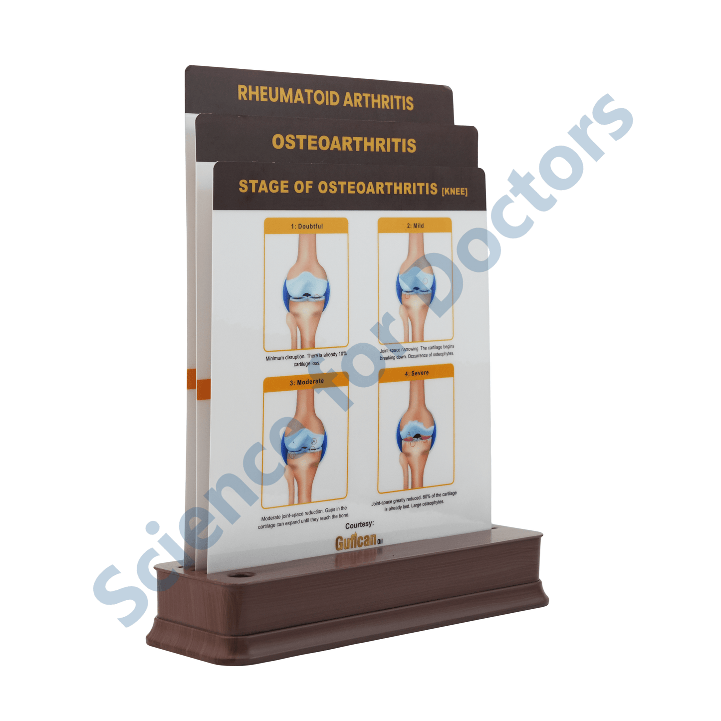 Osteoarthritis: 3 slide on stand