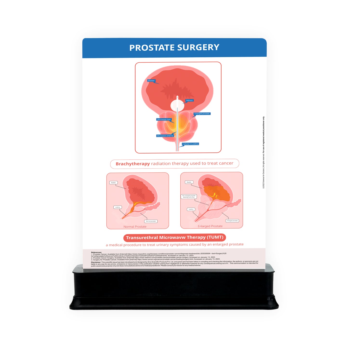 Prostate Surgery: 2 Slides With Stand