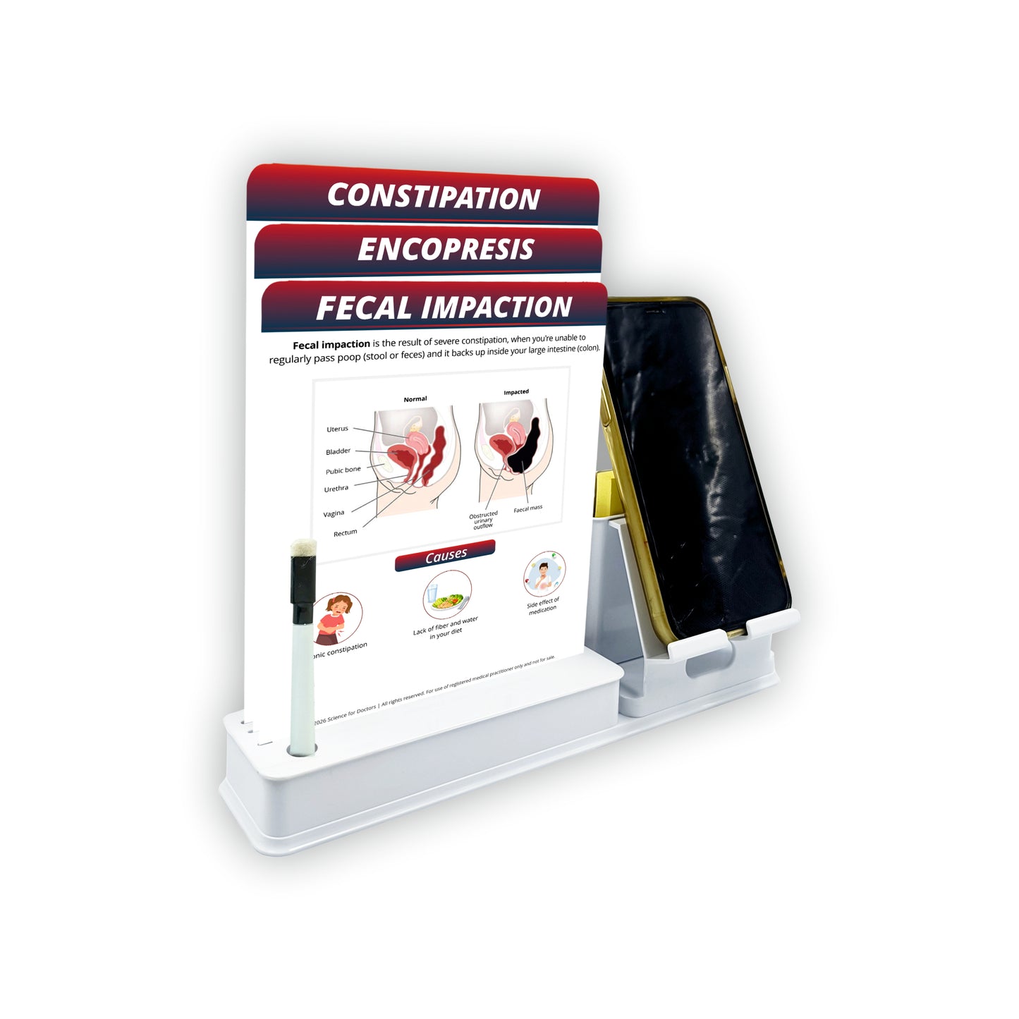 Smart - 3 Slides Write & Wipe With Mobile and Chit pad Stand - Fecal Impaction