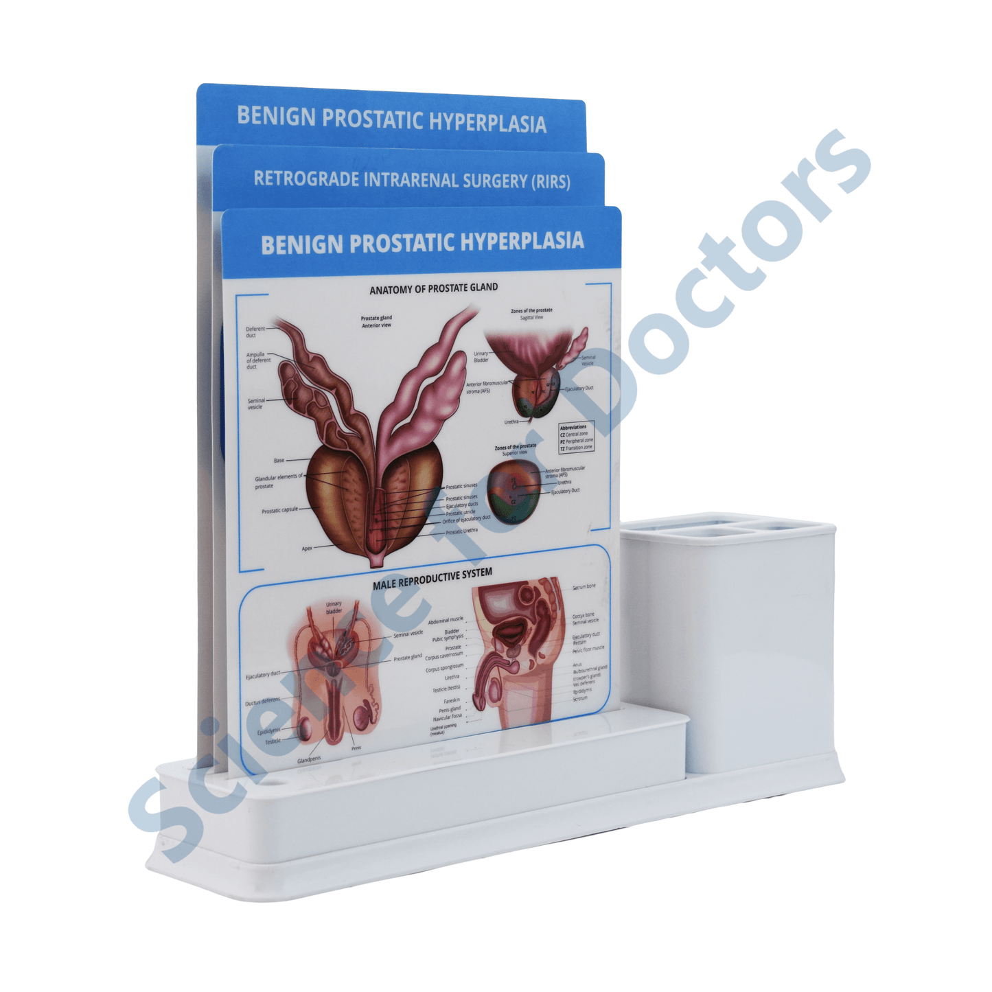 Benign Prostatic Hyperplasia: 3 Slides Write & Wipe with Stationary Stand