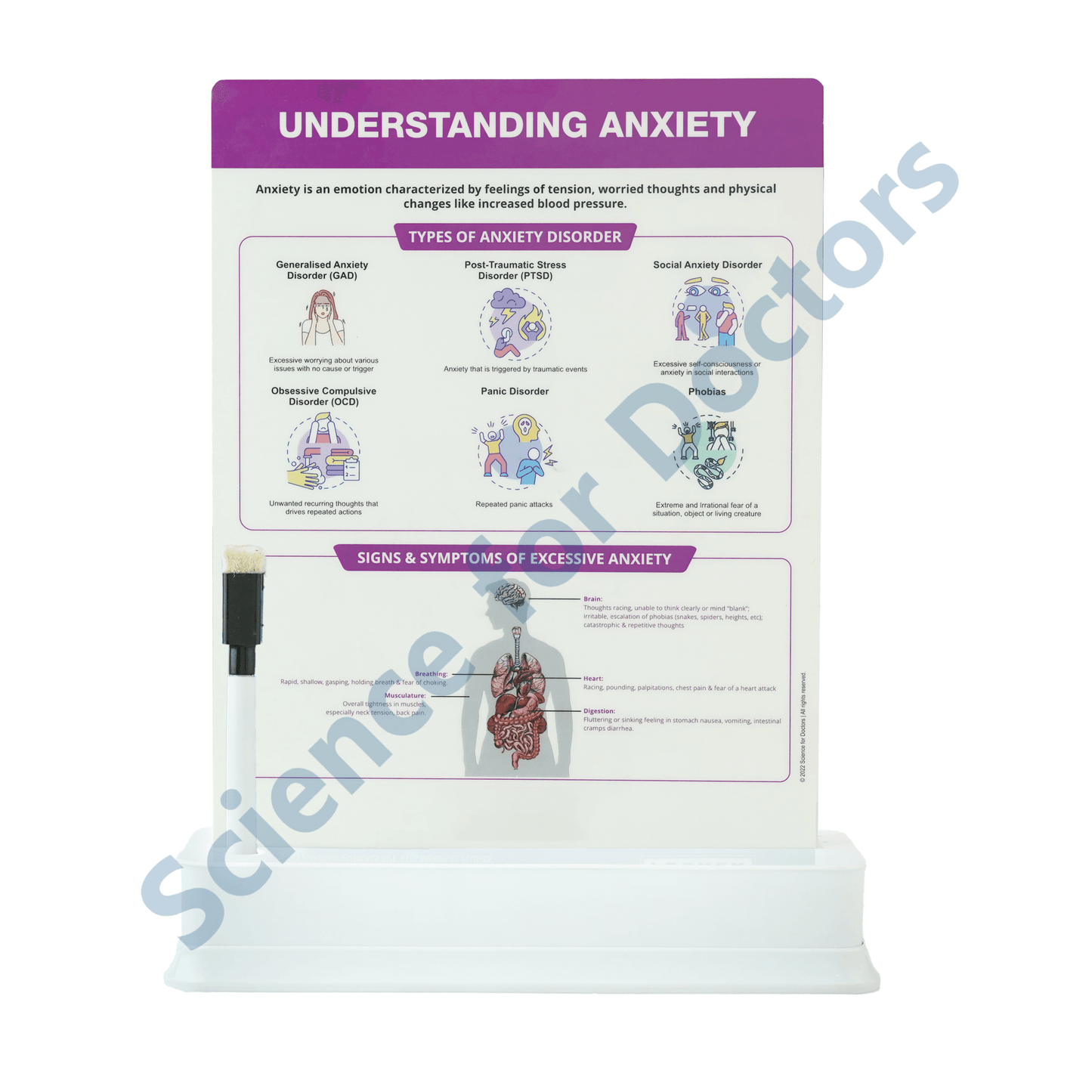 Understanding Anxiety: 1 Slide on stand