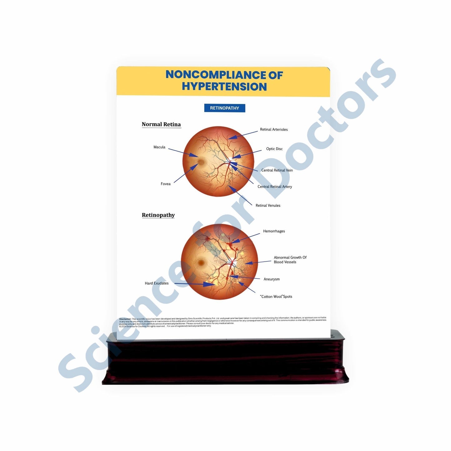 Noncompliance of hypertension: 2 Slide on stand