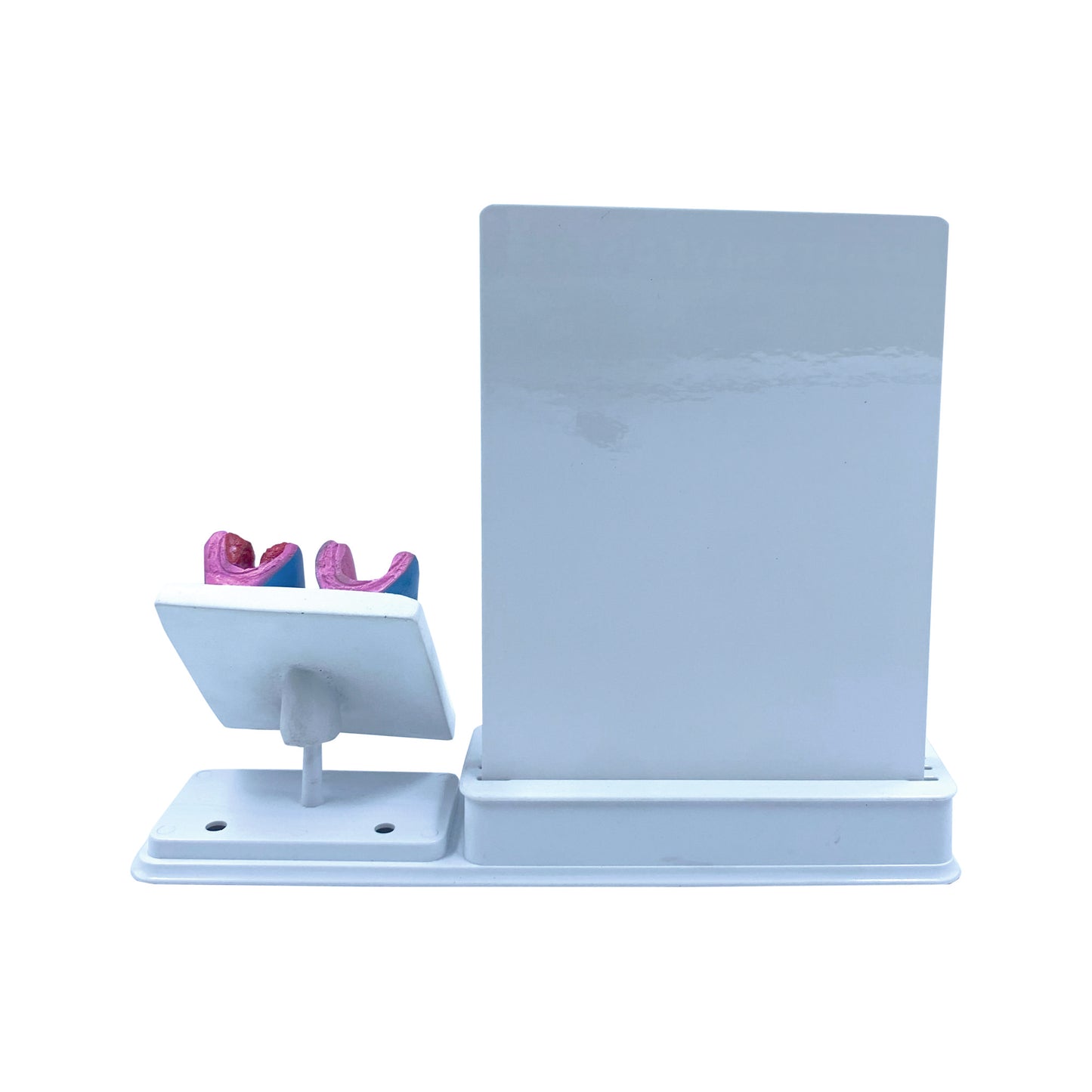 Atherosclerosis: Smart -3 Slides Write & Wipe With Anatomical Model