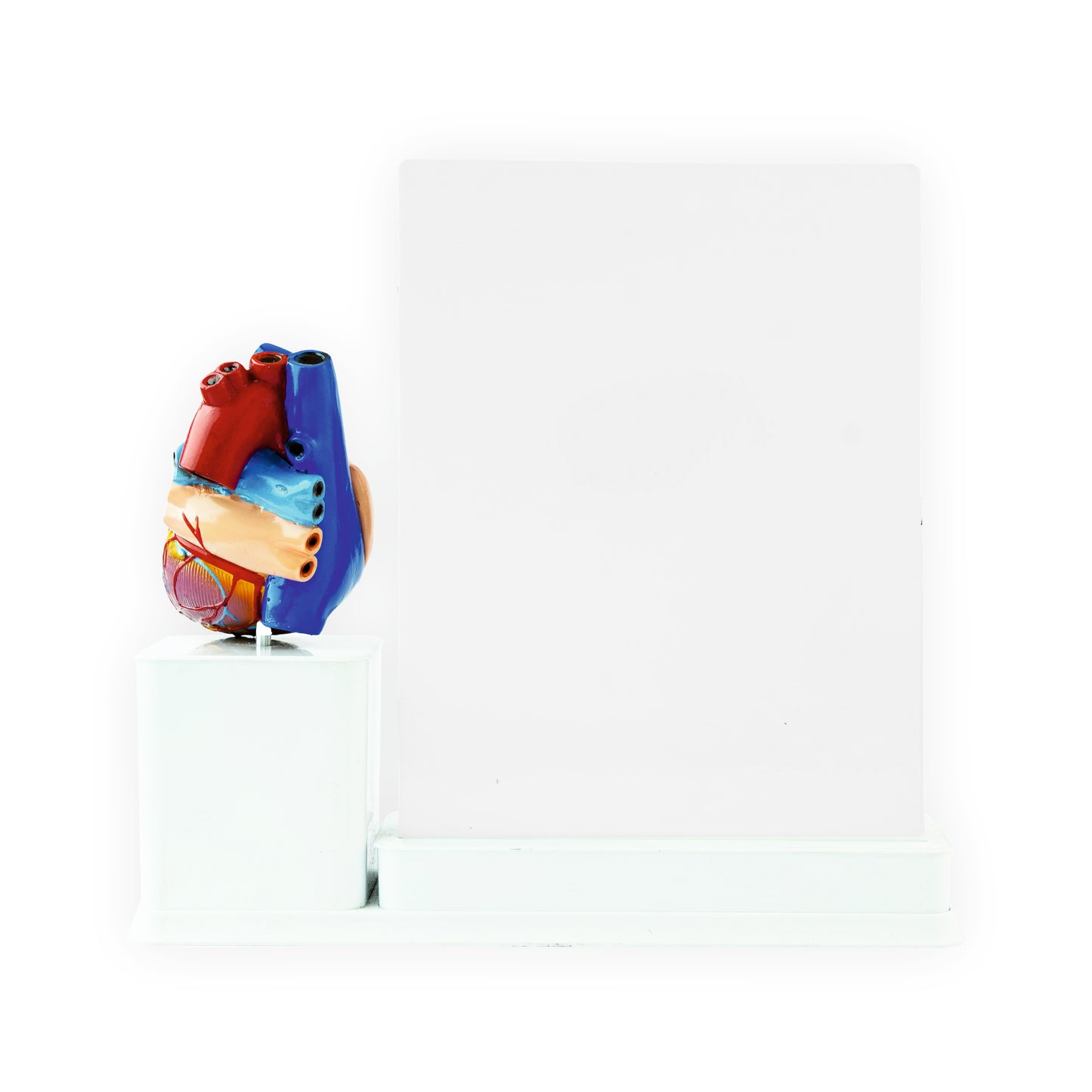 Atrial Fibrillation: 2 Slides Write & Wipe With Model On Stand