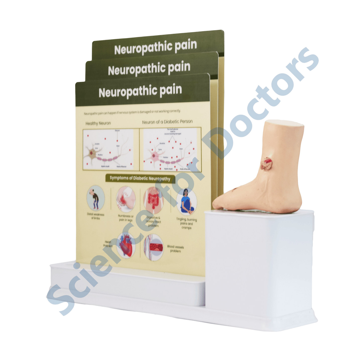 Neuropathic Pain : 3 Slide Write and Wipe with Anatomical Model on Stand