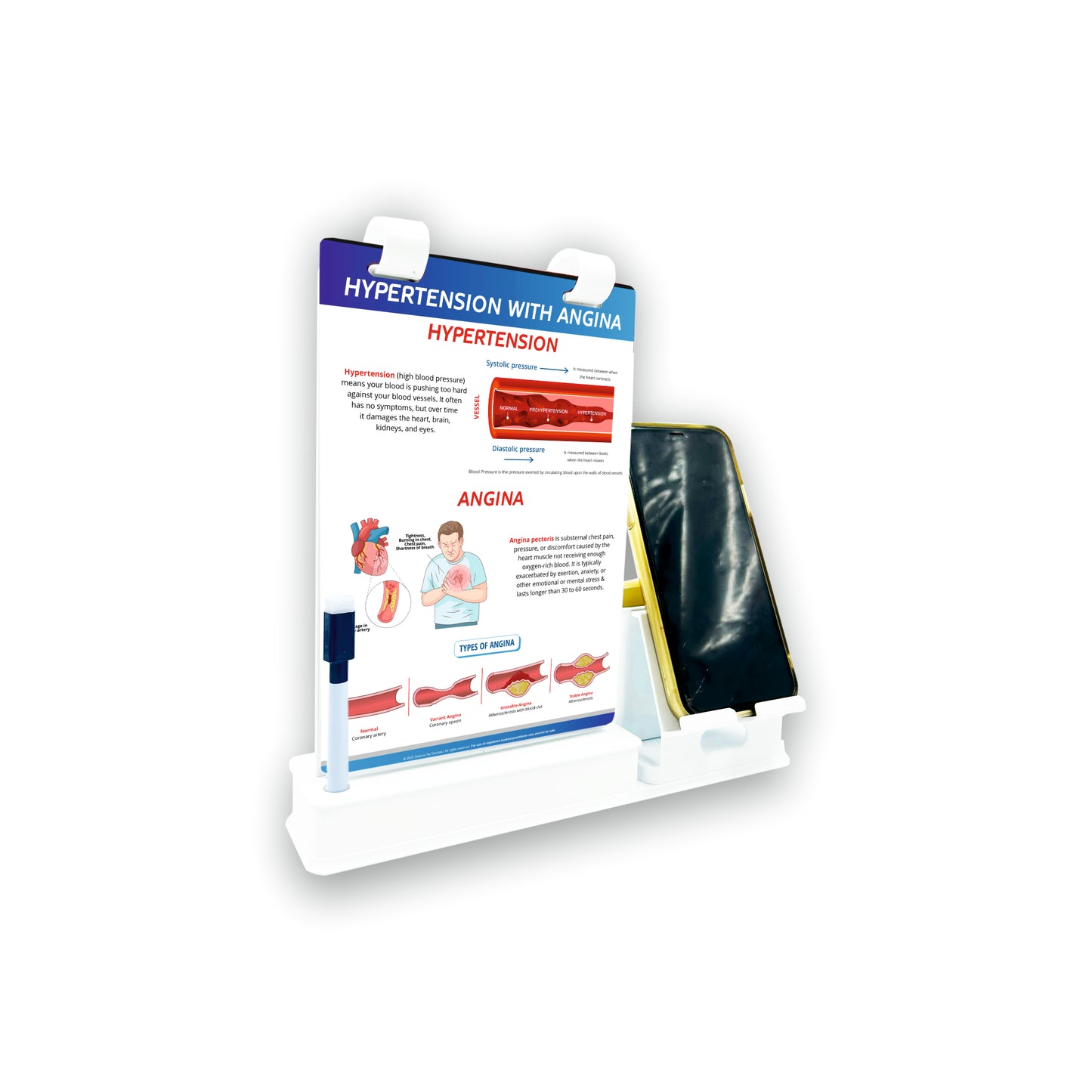 Smart -A5 Flip wipe With Mobile and Chit Pad Stand  - HYPERTENSION WITH ANGINA