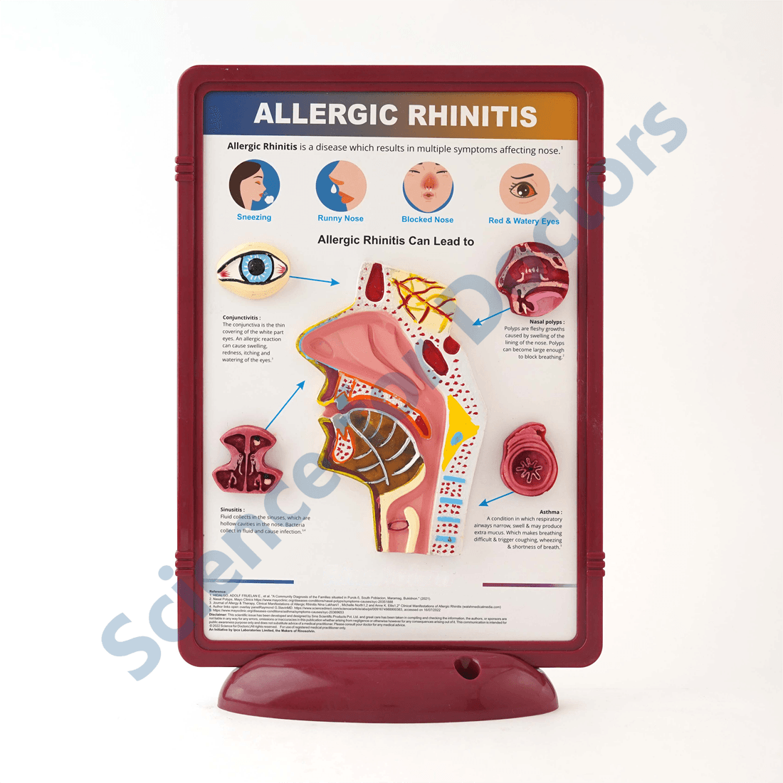 Allergic Rhinitis: 3D Therapy Frame