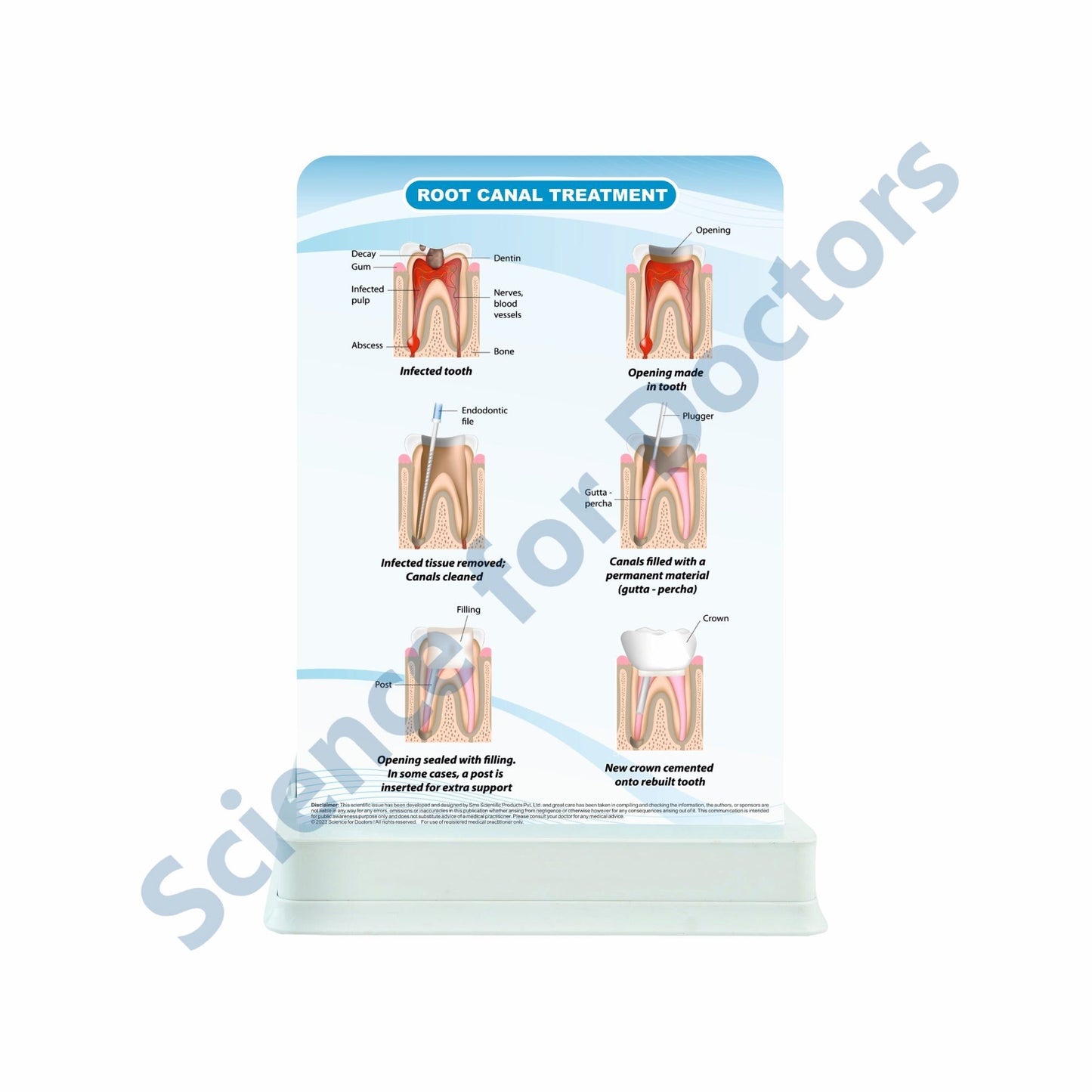 Root Canal Treatment: 1 Slide with Patient Leaflet Tray