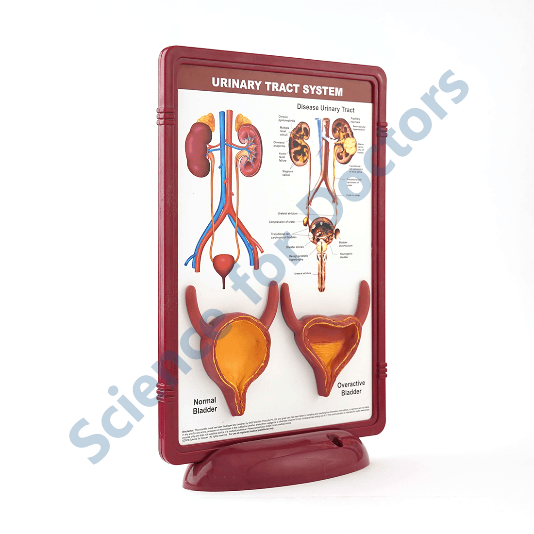 Urinary Tract System: 3D Therapy Frame