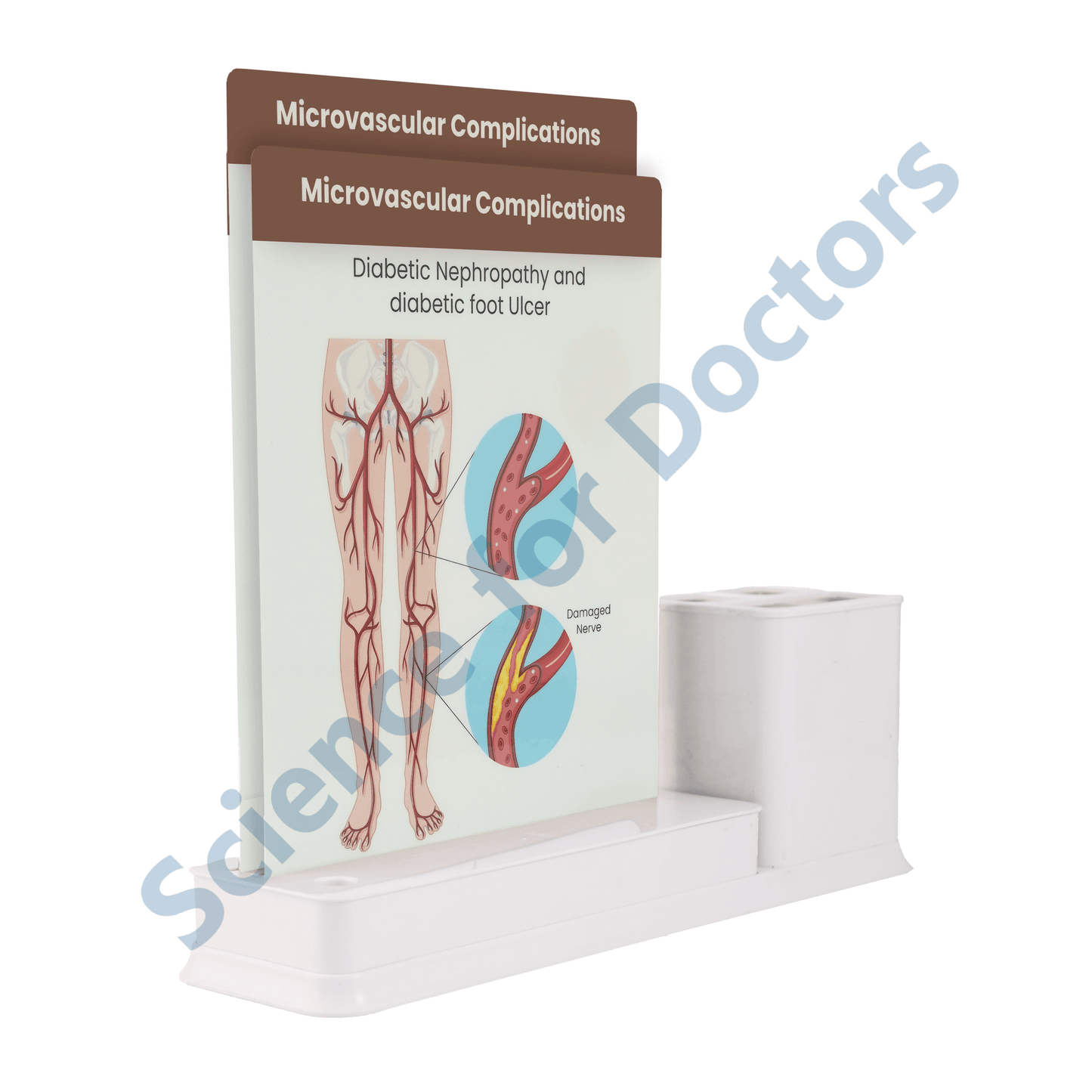 Microvascular Complications: 2 slide on stand with Stationary stand