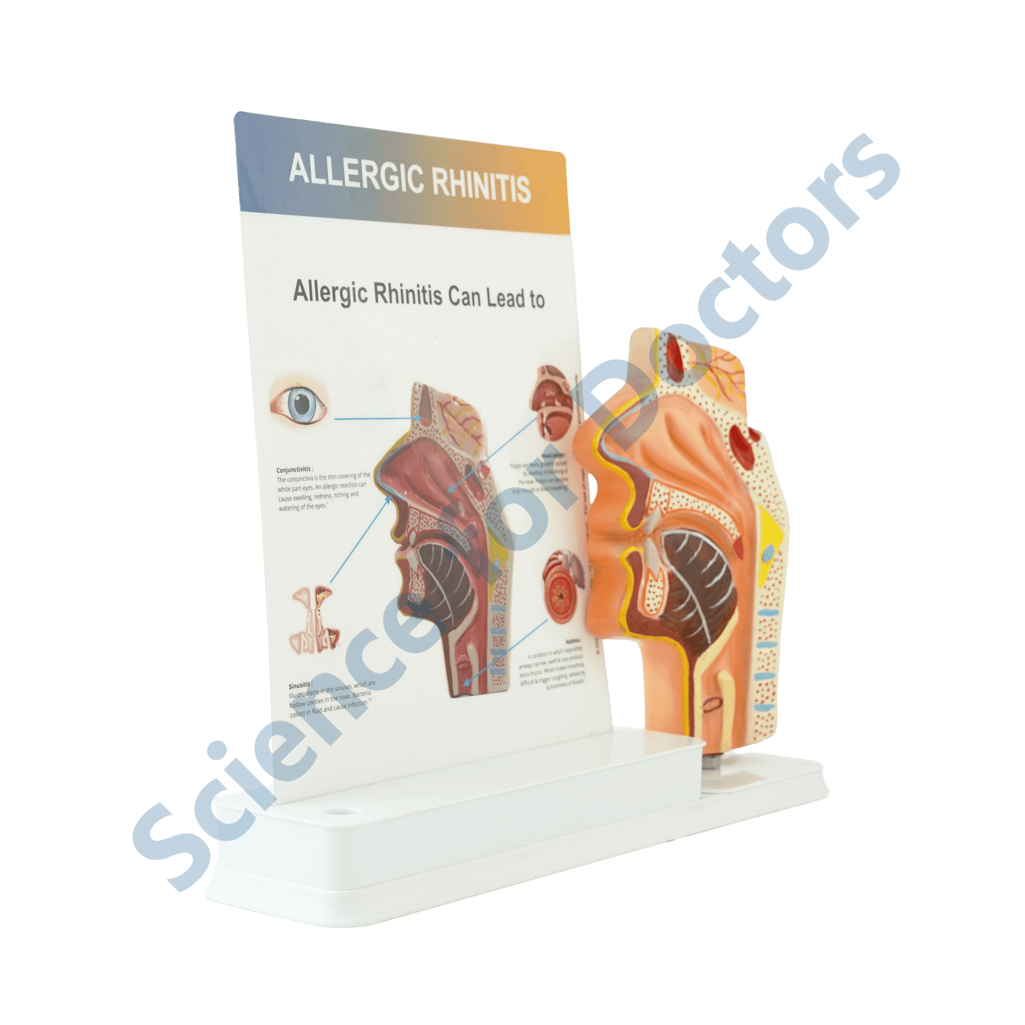 Allergic Rhinitis : 1 Slide write and wipe with anatomical model on stand