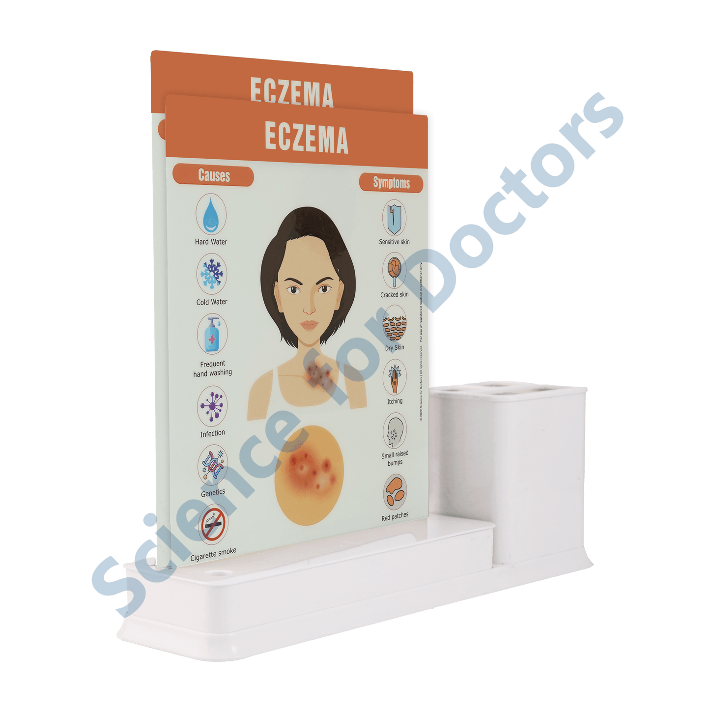 Eczema: 2 slide on stand with Stationary stand