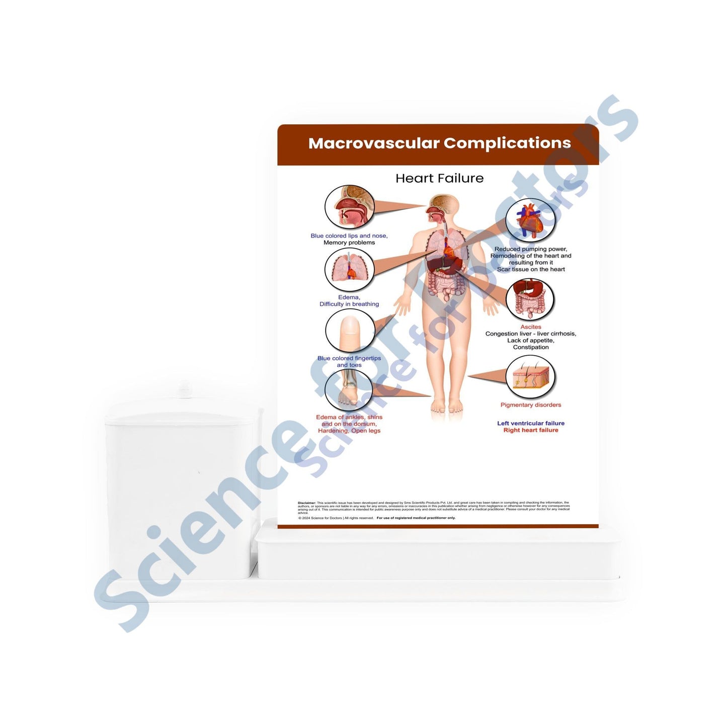 Complications of Diabetes: 3 Slide Write Wipe With Utility Container