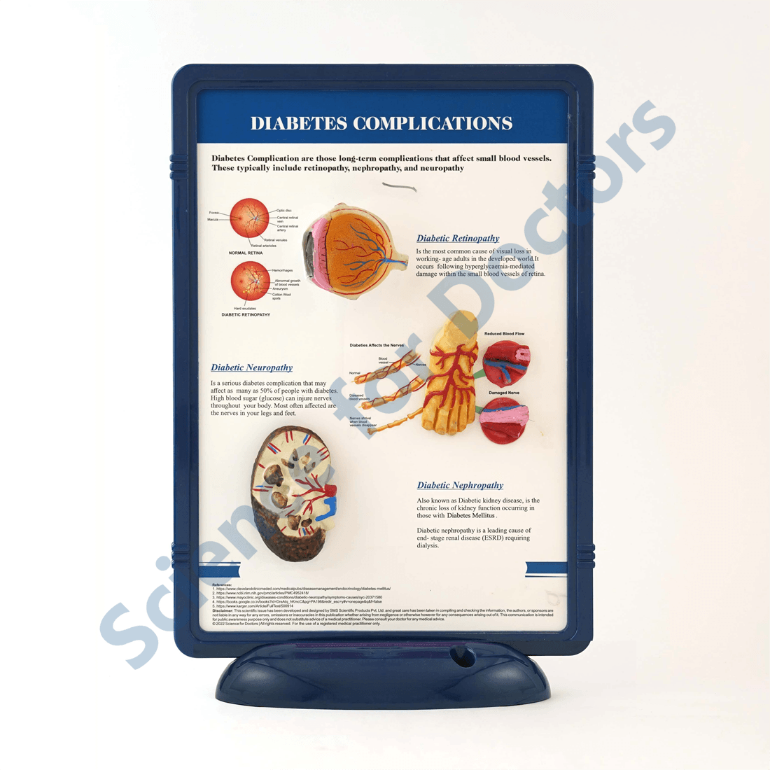 Diabetes Complications: 3D Therapy Frame