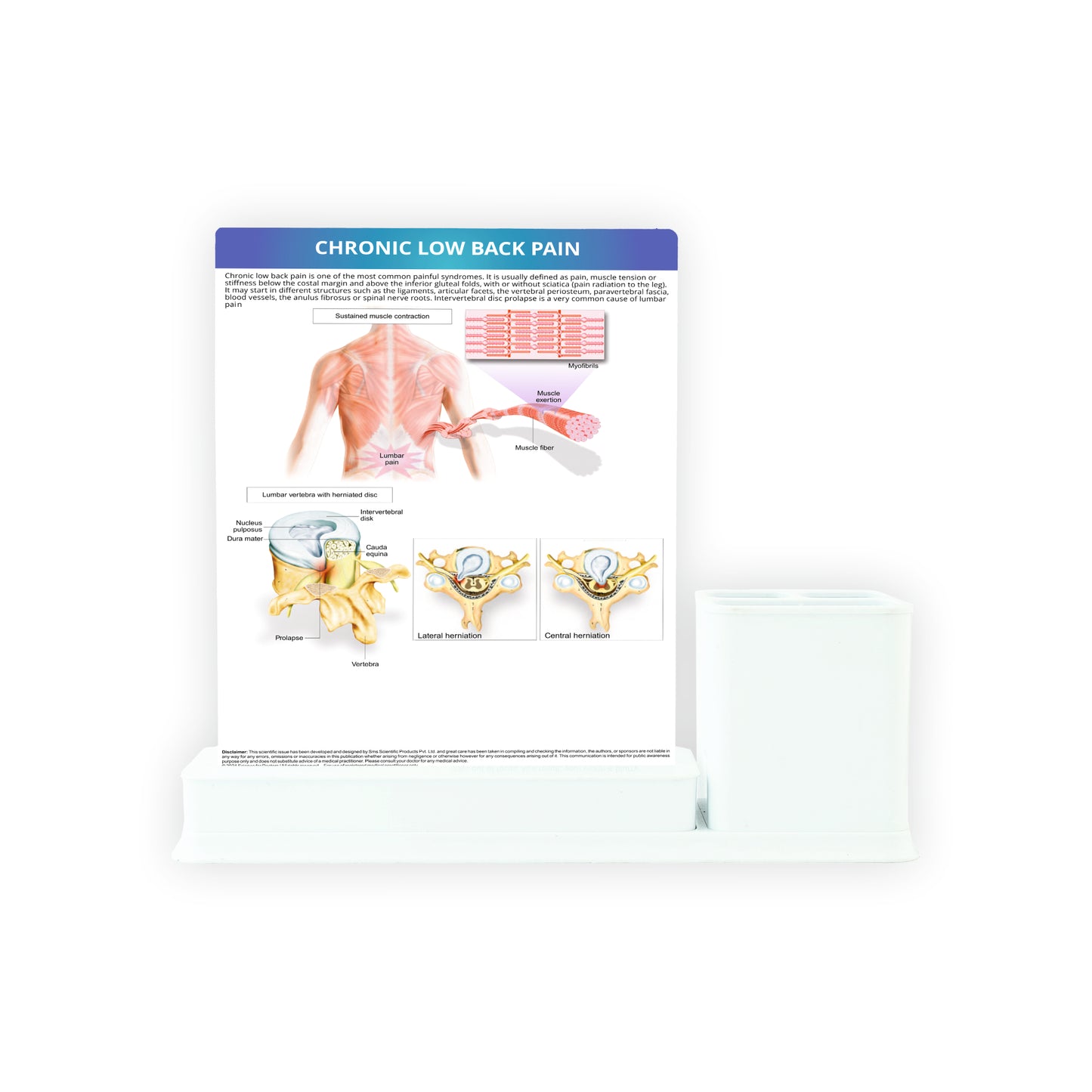 Types of Arthritis: 1 Slides Write & Wipe with Stationary Stand