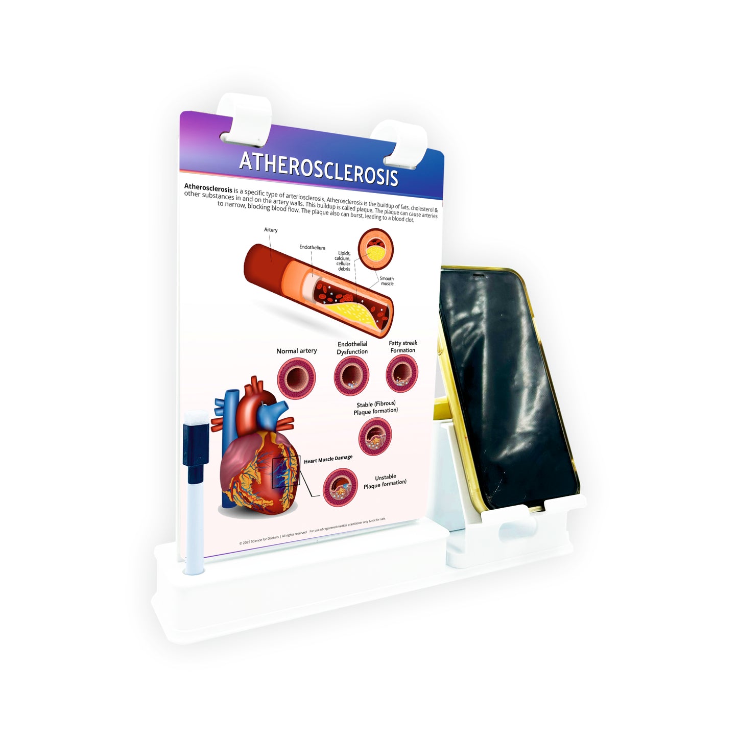 Smart -A5 Flip wipe With Mobile and Chit Pad Stand  - Atherosclerosis