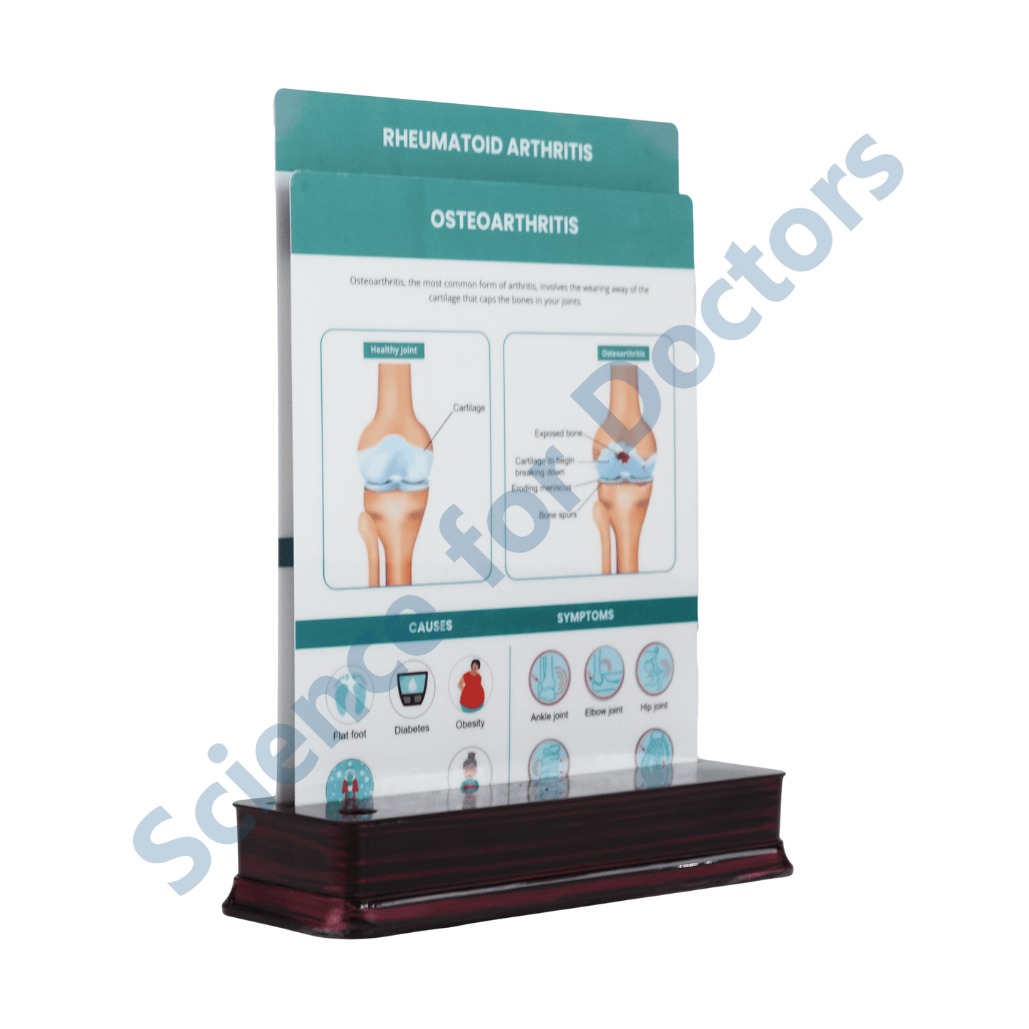 Osteoarthritis: 2 slide on stand