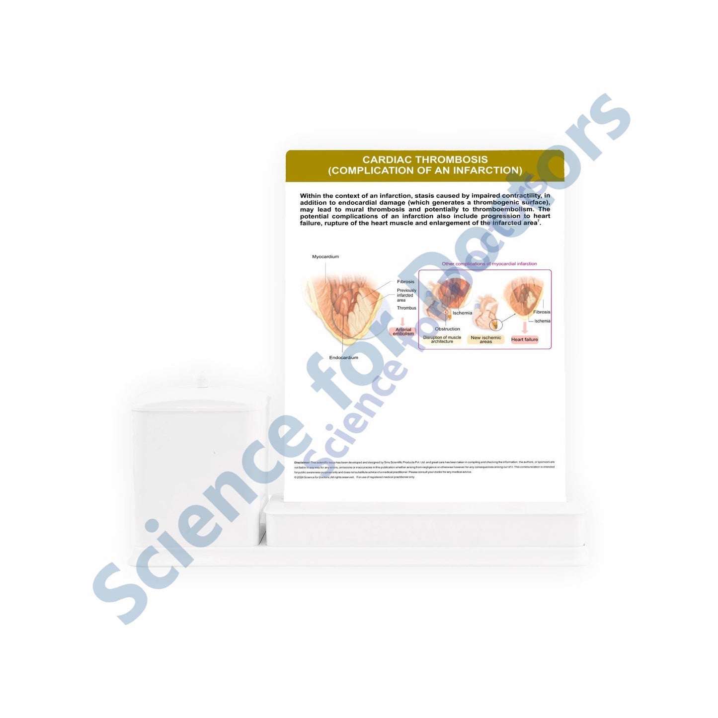 Plaque Rupture and Thrombosis: 3 Slides Write & Wipe with Stationary Stand