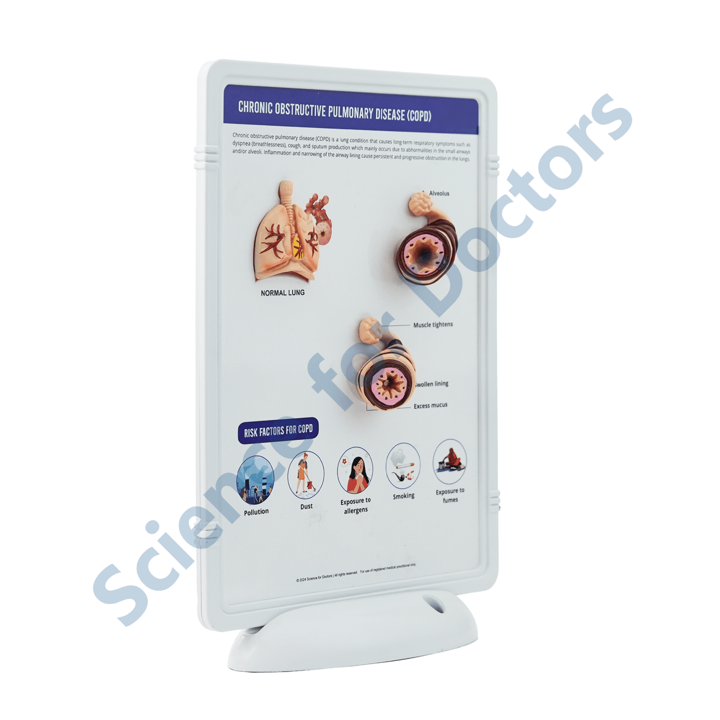 COPD(Chronic Obstructive Pulmonary Disease): 3D Therapy Frame