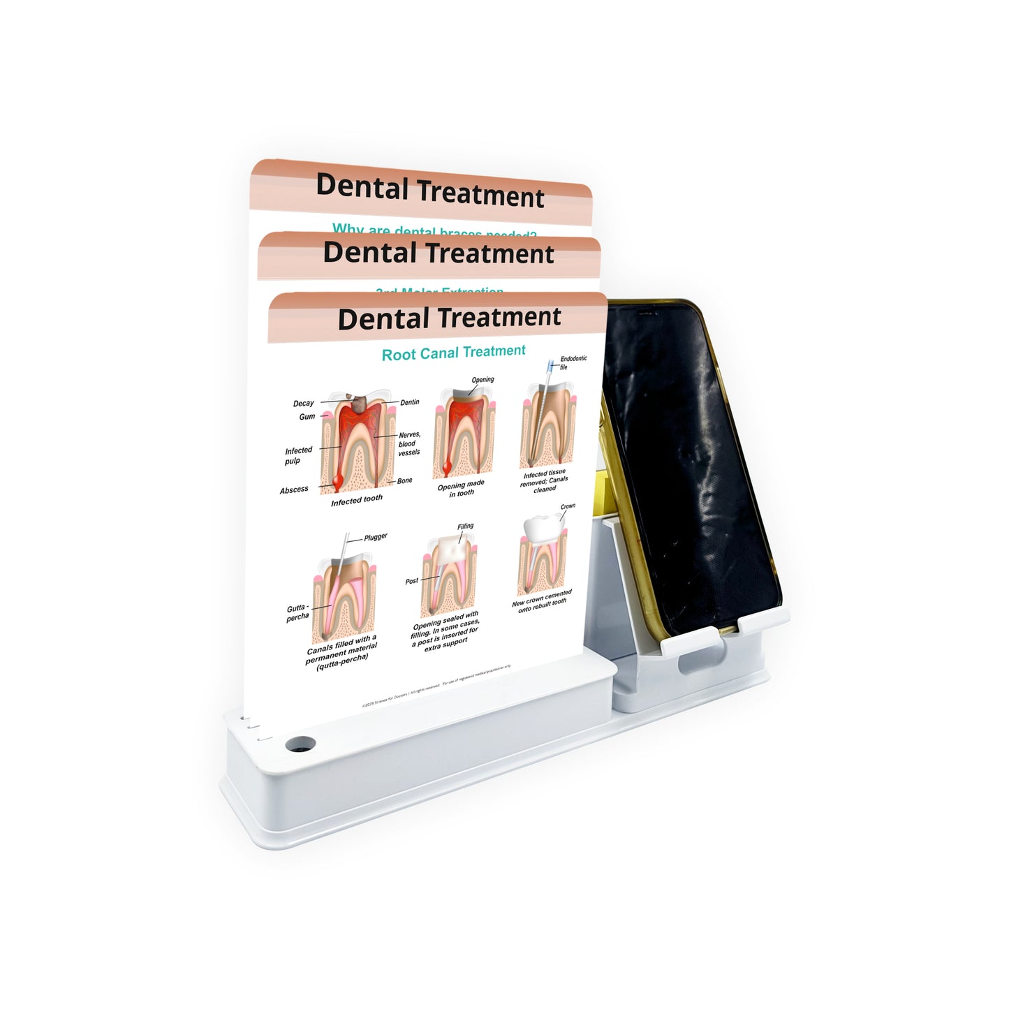 Smart - 3 Slides Write & Wipe With Mobile and Chit pad Stand - Dental Treatment