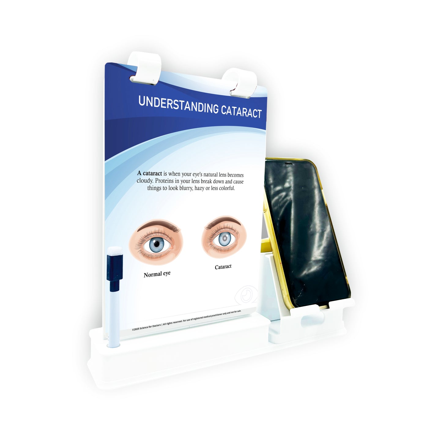 A5 Flip wipe With Mobile and Chit Pad Stand  - UNDERSTANDING CATARACT
