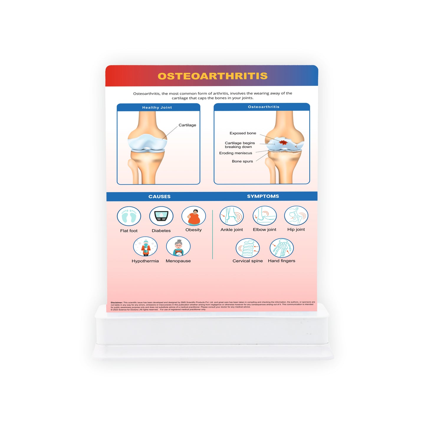 STAGE OF OSTEOARTHRITIS: 1 Slide on stand