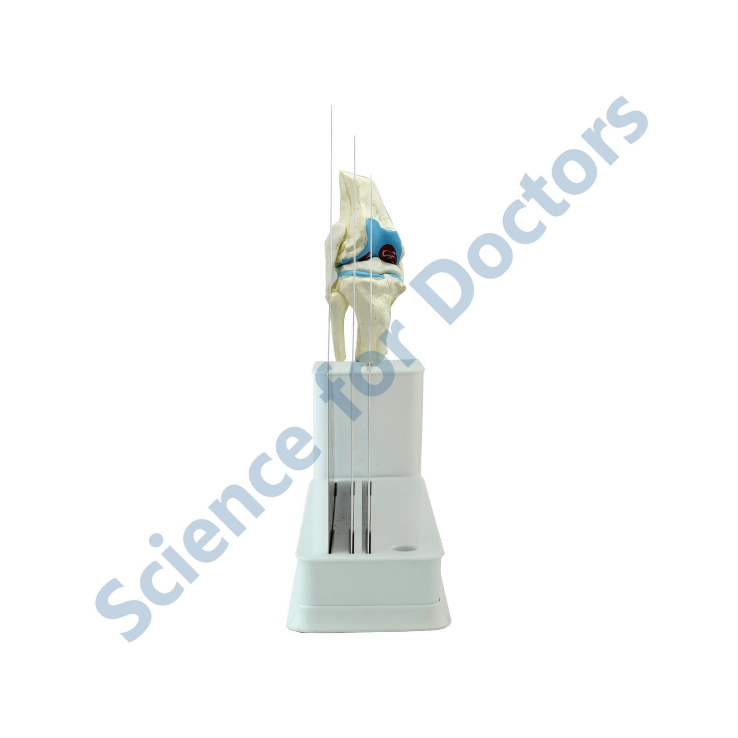 STAGE OF OSTEOARTHRITIS [KNEE]: 3 Slide Write and Wipe with Anatomical Model on Stand