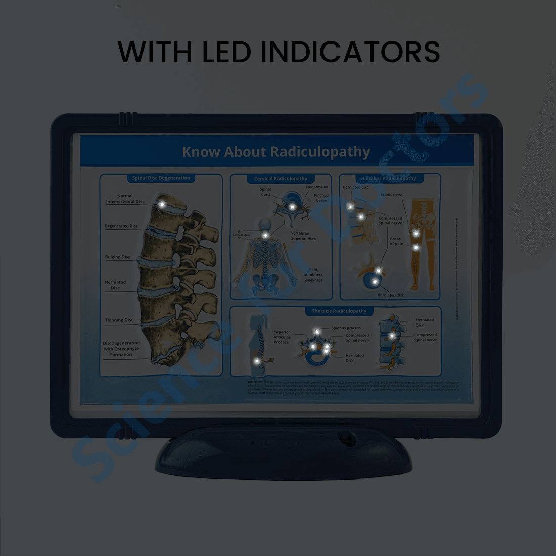 Know about Radiculopathy (With Light): 3D Pop Up Frame* (MOQ 300)