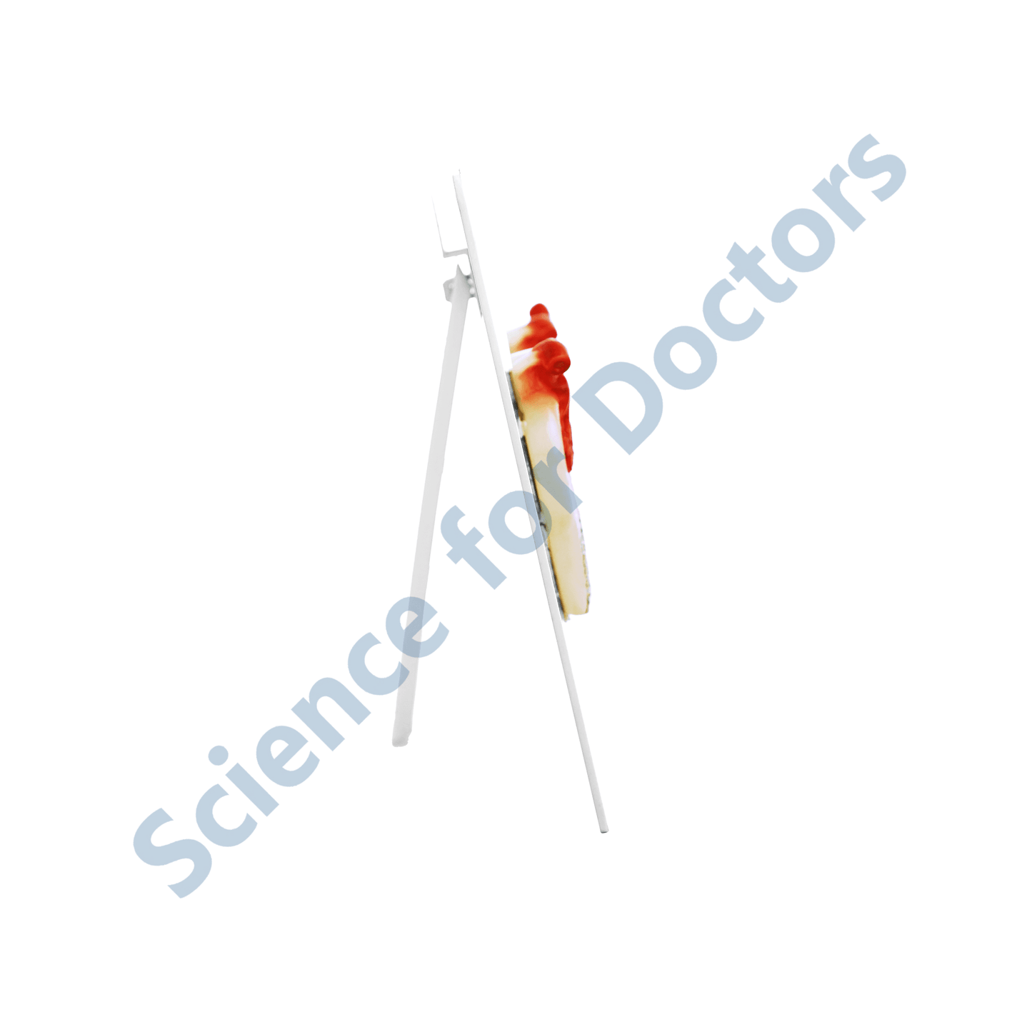 Cilnidipine & Renal Protection: 3d therapy Board