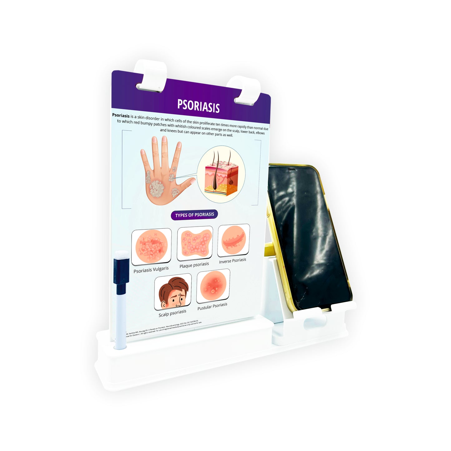 Smart -A5 Flip wipe With Mobile and Chit Pad Stand  - PSORIASIS