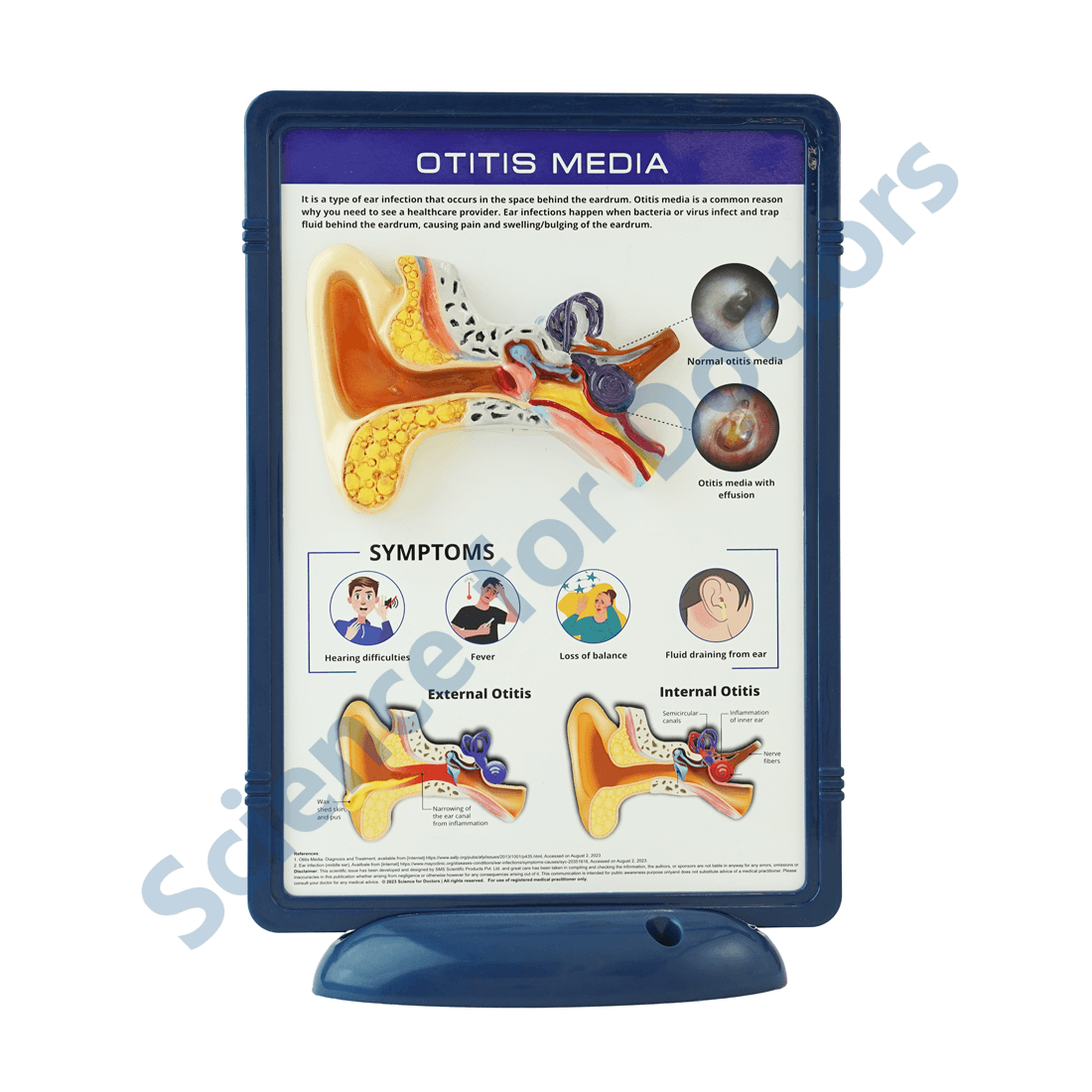 Otitis Media: 3D Therapy Frame