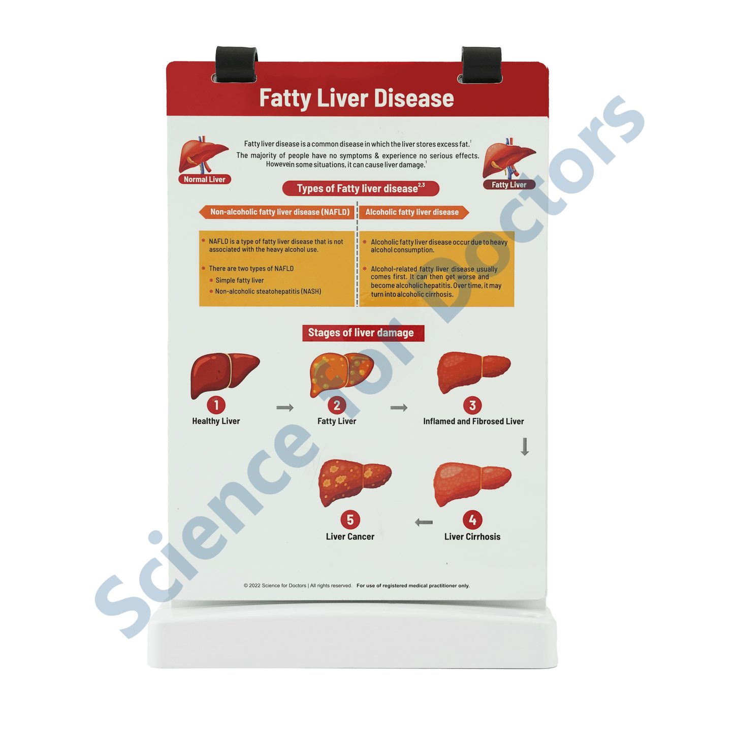 Fatty Liver Disease: A4 Flip Wipe with 3D Therapy Board