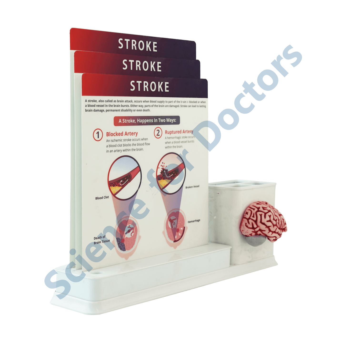 Stroke : 1 Slide Write and wipe with anatomical model on stationery stand