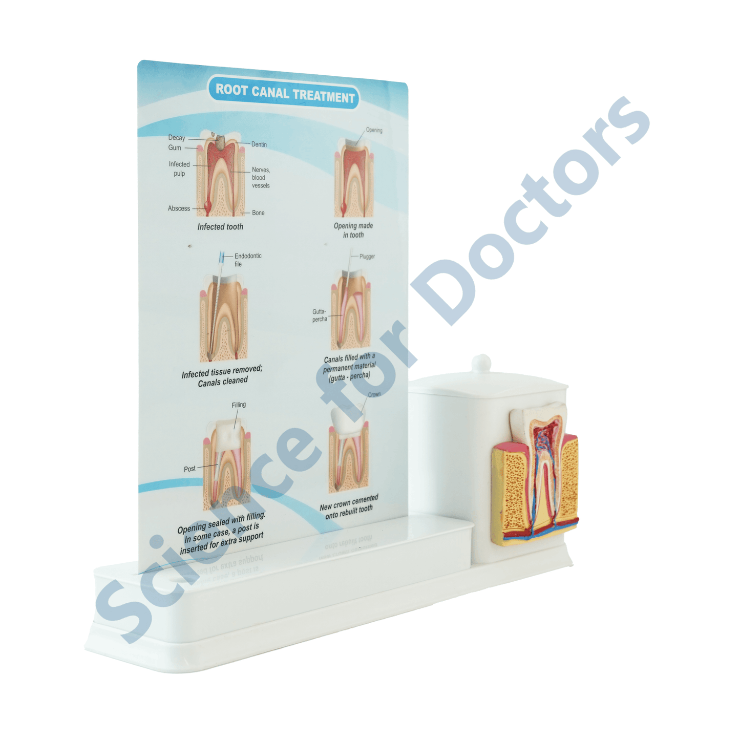 Root Canal Treatment : 1 Slide Write and wipe with anatomical model on stationery stand