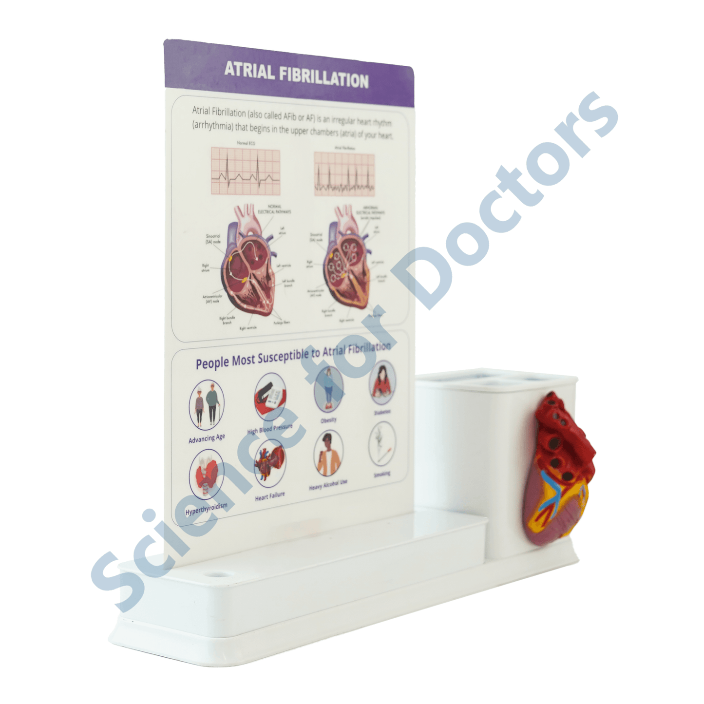 Atrial Fibrillation : 1 Slide Write and wipe with anatomical model on stationery stand